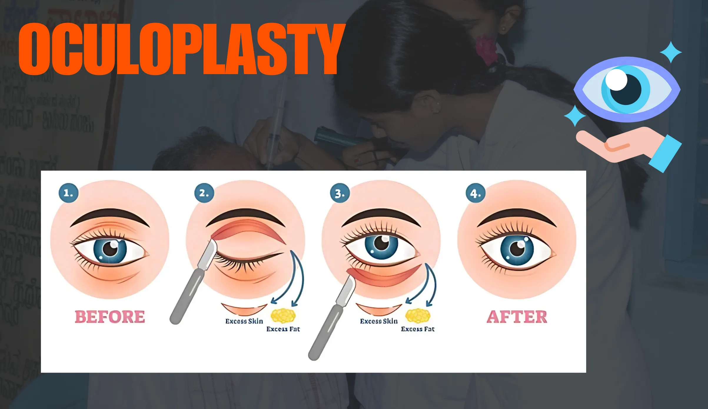 Oculoplasty